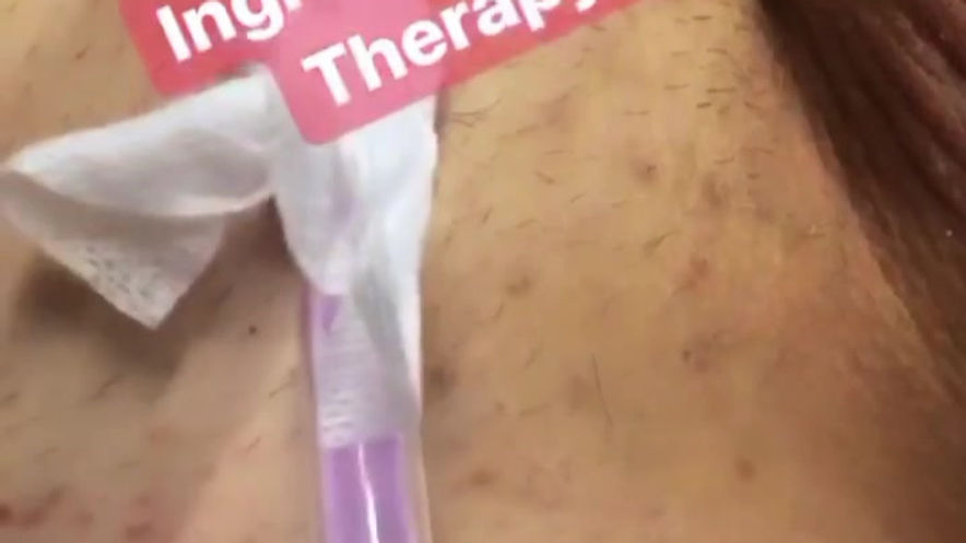 butt facial pennis facial alexspot24